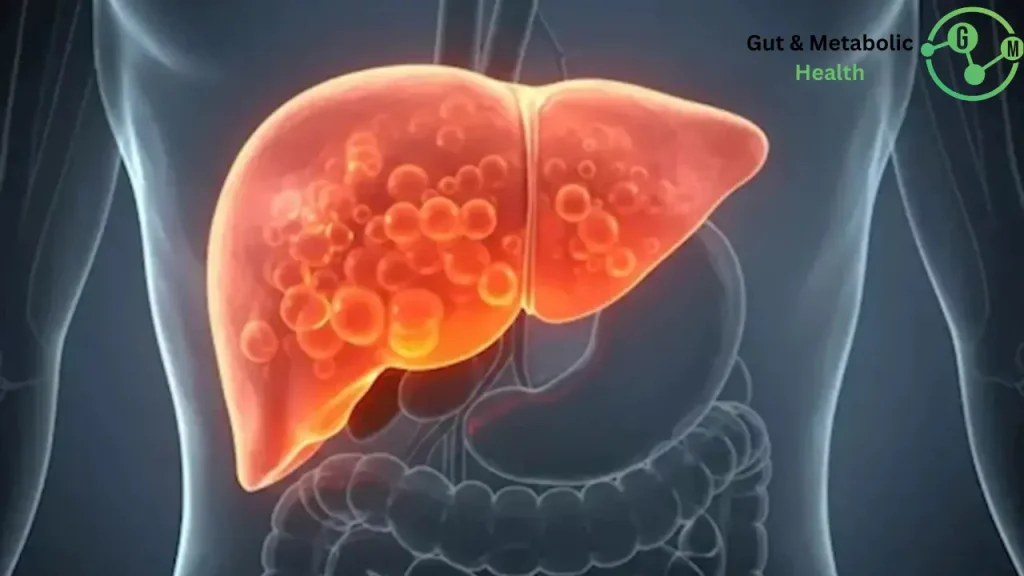 كيف اتخلص من دهون الكبد؟ كيف اتخلص من دهون الكبد