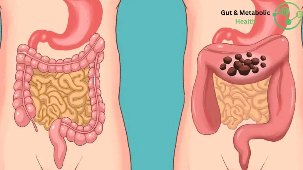 كيف انظف القولون؟ كيف انظف القولون؟